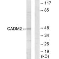 Western blot analysis of extracts from HepG2 cells, using CADM2 antibody.