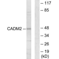 Western blot analysis of extracts from HepG2 cells, using CADM2 antibody.