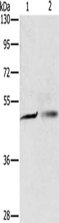 Gel: 8%SDS-PAGE, Lysate: 40 ug, Lane 1-2: A549 cells, A375 cells, Primary antibody: CSB-PA230596(PGBD4 Antibody) at dilution 1/250, Secondary antibody: Goat anti rabbit IgG at 1/8000 dilution, Exposure time: 5 seconds