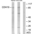 Western blot analysis of extracts from HepG2 cells and COLO205 cells, using CDH19 antibody.