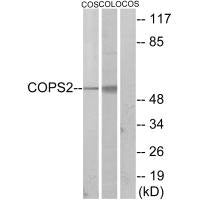 Western blot analysis of extracts from COS-7 cells and COLO205 cells, using COPS2 antibody.
