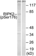 Western blot analysis of extracts from 293 cells, treated with UV (15mins), using RIPK2 (Phospho-Ser176) antibody. The lane on the right is treated with the synthesized peptide.