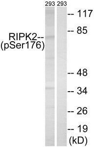Western blot analysis of extracts from 293 cells, treated with UV (15mins), using RIPK2 (Phospho-Ser176) antibody. The lane on the right is treated with the synthesized peptide.