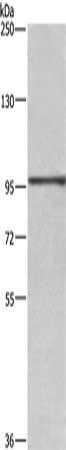 Gel: 6%SDS-PAGE, Lysate: 40 ug, Lane: A431 cells, Primary antibody: CSB-PA232358(RB1 Antibody) at dilution 1/500, Secondary antibody: Goat anti rabbit IgG at 1/8000 dilution, Exposure time: 5 seconds