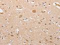 The image on the left is immunohistochemistry of paraffin-embedded Human brain tissue using CSB-PA232532(CSGALNACT2 Antibody) at dilution 1/30, on the right is treated with fusion protein. (Original magnification: ×200)