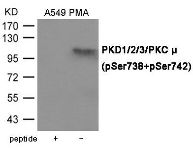 Western blot analysis of extracts from A549 cells with PMA using PKD1/2/3/PKC μ (Phospho-Ser738+Ser742) Antibody.The lane on the left is treated with the antigen-specific peptide.