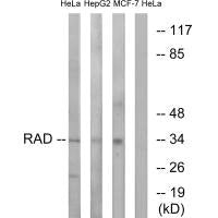 Western blot analysis of extracts from HeLa cells, HepG2 cells and MCF-7 cells, using RAD antibody.