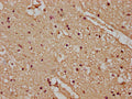 IHC image of CSB-PA23389A0Rb diluted at 1:100 and staining in paraffin-embedded human brain tissue performed on a Leica BondTM system. After dewaxing and hydration, antigen retrieval was mediated by high pressure in a citrate buffer (pH 6.0). Section was blocked with 10% normal goat serum 30min at RT. Then primary antibody (1% BSA) was incubated at 4&deg;C overnight. The primary is detected by a biotinylated secondary antibody and visualized using an HRP conjugated SP system.