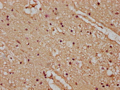 IHC image of CSB-PA23389A0Rb diluted at 1:100 and staining in paraffin-embedded human brain tissue performed on a Leica BondTM system. After dewaxing and hydration, antigen retrieval was mediated by high pressure in a citrate buffer (pH 6.0). Section was blocked with 10% normal goat serum 30min at RT. Then primary antibody (1% BSA) was incubated at 4&deg;C overnight. The primary is detected by a biotinylated secondary antibody and visualized using an HRP conjugated SP system.