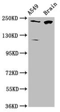 Western Blot
Positive WB detected in: A549 whole cell lysate, Rat brain tissue
All lanes: CABIN1 antibody at 3.1µg/ml
Secondary
Goat polyclonal to rabbit IgG at 1/50000 dilution
Predicted band size: 247, 238 kDa
Observed band size: 247 kDa