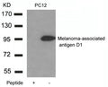 Western blot analysis of extracts from PC12 cells using Melanoma-associated antigen D1 Antibody and the same antibody preincubated with blocking peptide.