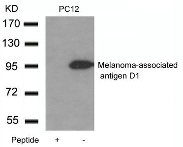 Western blot analysis of extracts from PC12 cells using Melanoma-associated antigen D1 Antibody and the same antibody preincubated with blocking peptide.