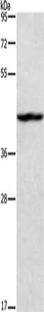 Gel: 8%SDS-PAGE, Lysate: 40 ug, Lane: K562 cells, Primary antibody: CSB-PA234177(TBX20 Antibody) at dilution 1/500, Secondary antibody: Goat anti rabbit IgG at 1/8000 dilution, Exposure time: 40 seconds