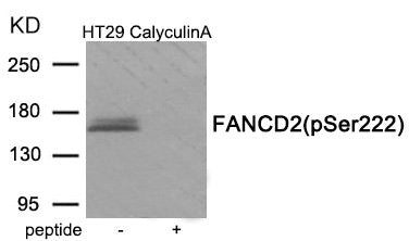 Western blot analysis of extracts from HT29 cells treated with CalyculinA using Phospho-FANCD2 (Ser222) antibody.The lane on the right is treated with the antigen-specific peptide.