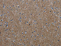 The image on the left is immunohistochemistry of paraffin-embedded Human brain tissue using CSB-PA234599(GNG2 Antibody) at dilution 1/60, on the right is treated with fusion protein. (Original magnification: ×200)