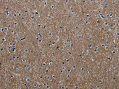 The image on the left is immunohistochemistry of paraffin-embedded Human brain tissue using CSB-PA234599(GNG2 Antibody) at dilution 1/60, on the right is treated with fusion protein. (Original magnification: ×200)