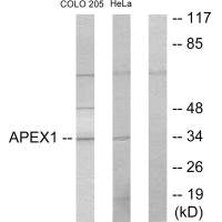 Western blot analysis of extracts from COLO205 cells and HeLa cells, using APEX1 antibody.