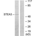 Western blot analysis of extracts from COLO205 cells, using STEA3 antibody.
