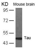 Western blot analysis of extracts from mouse brain tissue using Tau(Ab-231) Antibody.