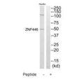 Western blot analysis of extracts from HuvEc cells, using ZNF446 antibody.
