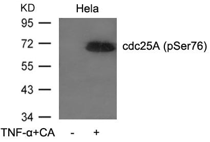 Western blot analysis of extracts from Hela cells untreated or treated with TNF-a and CA using cdc25A(Phospho-Ser76) Antibody.