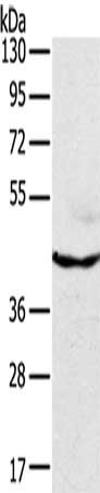 Gel: 8%SDS-PAGE, Lysate: 40 ug, Lane: A172 cells, Primary antibody: CSB-PA236755(MAPK8 Antibody) at dilution 1/200, Secondary antibody: Goat anti rabbit IgG at 1/8000 dilution, Exposure time: 3 seconds