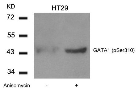 Western blot analysis of extracts from HT29 cells untreated or treated with Anisomycin using GATA1(Phospho-Ser310) Antibody.