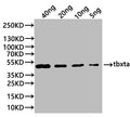 Western Blot
Positive WB detected in: recombinant protein
All lanes:tbxta Antibody at 1:1000
Secondary
Goat polyclonal to rabbit IgG at 1/20000 dilution
Predicted band size: 46.5 kDa
Observed band size: 44 kDa