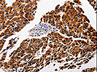 IL1RAP Antibody – Figure 1 of 1