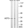 Western blot analysis of extracts from HepG2 cells and 293 cells, using SLC25A6 antibody.