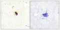 Immunohistochemistry analysis of paraffin-embedded human brain tissue using AurB/C (Phospho-Thr236/202) antibody. The picture on the right is treated with the synthesized peptide.