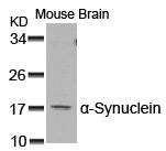 Western blot analysis of extracts from Mouse Brain tissue using a-Synuclein(Ab-129) Antibody.