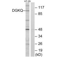 Western blot analysis of extracts from HT-29 cells, using DGKQ antibody.