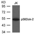 Western blot analysis of extracts from JK cells using p56Dok-2(Ab-299) Antibody.