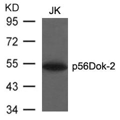 Western blot analysis of extracts from JK cells using p56Dok-2(Ab-299) Antibody.