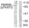 Western blot analysis of extracts from 293 cells treated with UV using p90 RSK (Phospho-Thr573) Antibody.The lane on the right is treated with the antigen-specific peptide.