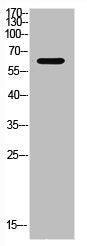XRCC6 Antibody – Figure 1 of 1