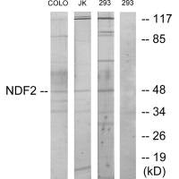 Western blot analysis of extracts from COLO cells, Jurkat cells and 293 cells, using NDF2 antibody.