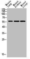Western blot analysis of mouse-lung mouse-brain mouse-heart Hela mouse-liver lysate, antibody was diluted at 500. Secondary antibody  was diluted at 1:20000