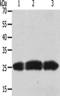 Gel: 8+12%SDS-PAGE, Lysate: 50 ug, Lane 1-3: Human brain tissue, PC3 cells, hela cells, Primary antibody: CSB-PA241266(TIMP4 Antibody) at dilution 1/200, Secondary antibody: Goat anti rabbit IgG at 1/8000 dilution, Exposure time: 30 seconds