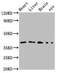 Western Blot
Positive WB detected in: Zebrafish heart tissue, Zebrafish liver tissue, Zebrafish brain tissue, Zebrafish eye tissue
All lanes: fas antibody at 3.1µg/ml
Secondary
Goat polyclonal to rabbit IgG at 1/50000 dilution
Predicted band size: 34 kDa
Observed band size: 42 kDa