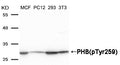 Western blot analysis of extracts from MCF, PC12, 293 and 3T3 cells using PHB (Phospho-Tyr259) Antibody.