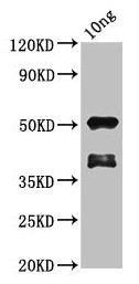 Western Blot
Positive WB detected in Recombinant protein
All lanes: brca2 antibody at 1.7µg/ml
Secondary
Goat polyclonal to rabbit IgG at 1/50000 dilution
Predicted band size: 45 kDa
Observed band size: 52 kDa