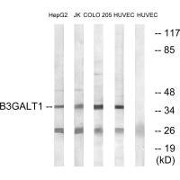 Western blot analysis of extracts from HepG2 cells, Jurkat cells, COLO cells and HUVEC cells, using B3GALT1 antibody.