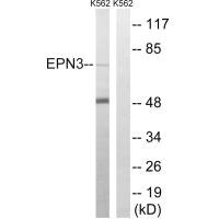 Western blot analysis of extracts from K562 cells, using EPN3 antibody.
