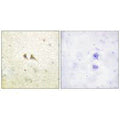 Immunohistochemistry analysis of paraffin-embedded human brain tissue using FAS ligand antibody.
