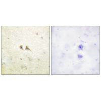 Immunohistochemistry analysis of paraffin-embedded human brain tissue using FAS ligand antibody.