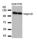 Western blot analysis of extracts from HL60 and HT29 cells using Integrin b3(Ab-773) Antibody.