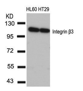 Western blot analysis of extracts from HL60 and HT29 cells using Integrin b3(Ab-773) Antibody.