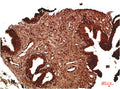 ATM Antibody – Figure 1 of 3